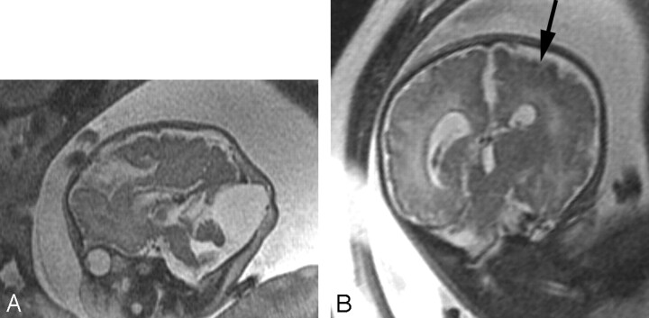 Fig 7.