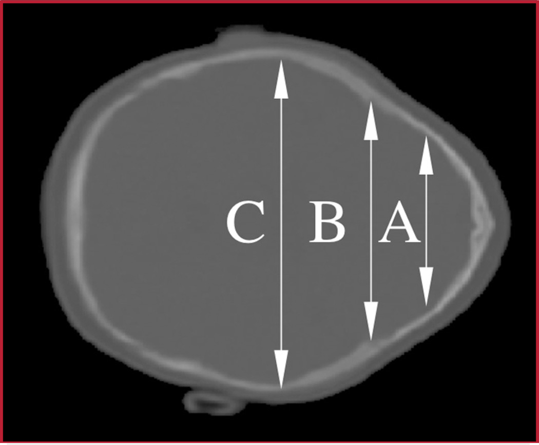 FIGURE 3