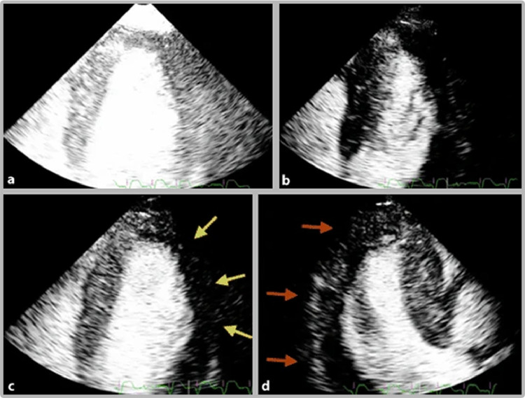 FIG 4