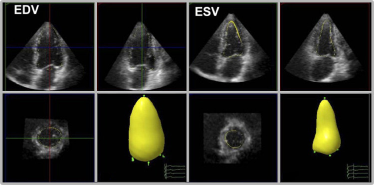 FIG 5