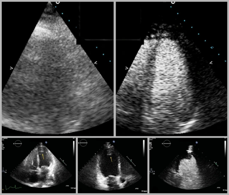 FIG 3