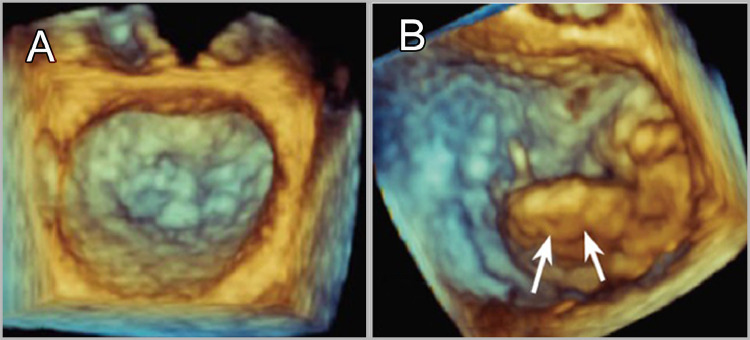 FIG 6