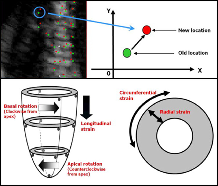 FIG 1