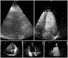 FIG 3