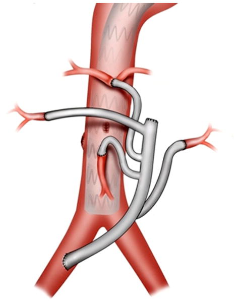 Fig 2