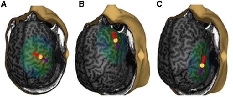 Fig. 1