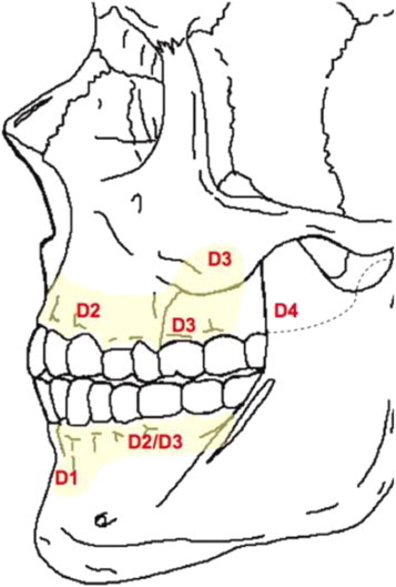 Fig. 2