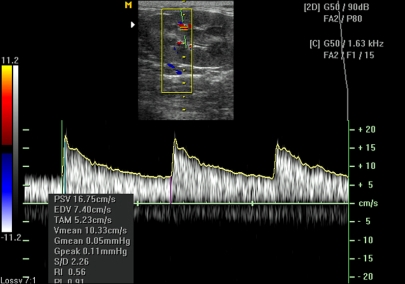 Fig. 4