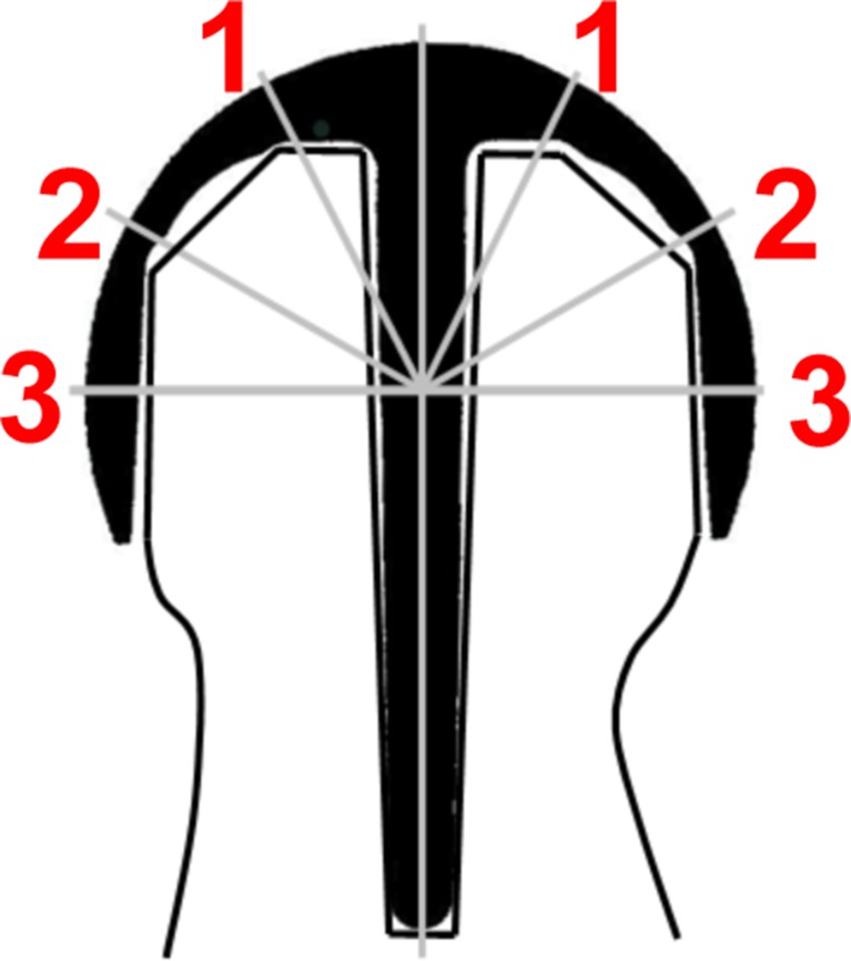 Fig. 2