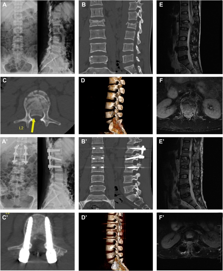 Fig. 2