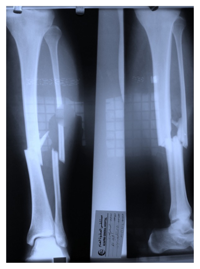 Figure 1C