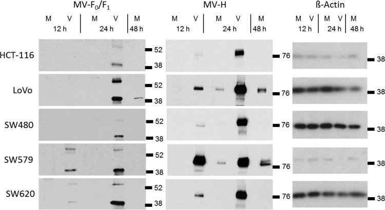 FIG 3