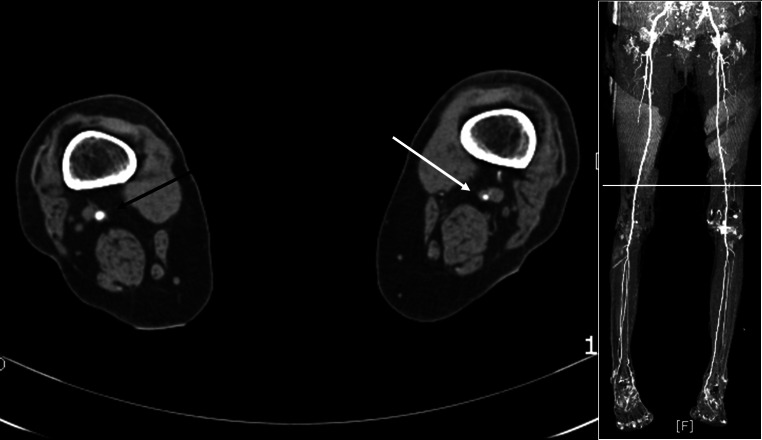 Fig. 2