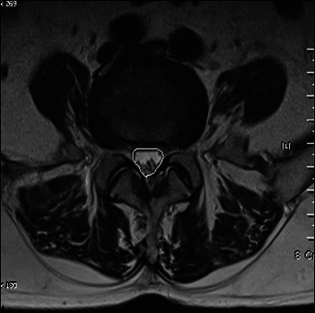 Fig. 1