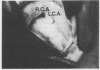 153