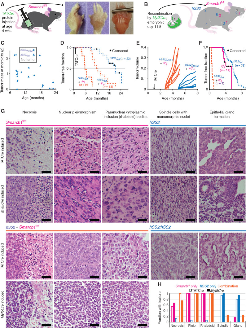 Figure 1. SS18–SSX and Smarcb1 compete in the balance between sarcomagenesis and tumor suppression, driving different phenotypes. A, Schematic for TATCre protein injection into the paw and gross images of a tumor that developed over a year later in a Smarcb1fl/fl mouse. B, Schematic of the expression and recombination pattern from Myf5Cre and a mouse with anatomic distribution of Myf5Cre; Smarcb1fl/fl and Myf5Cre;hSS2 tumors from 16 consecutive mice in each group (two-tailed Fisher exact test for incidence of tumors in each cohort, P = 0.0002; χ2 = 17.03 with four degrees of freedom and P = 0.0019 for comparing distributions of tumors in each cohort). C, Distribution of tumor size versus time at morbidity among cohorts of hSS2/wt and hSS2/hSS2 mice in which sarcomagenesis was initiated at age 4 weeks by hind-limb injection of TATCre (two-tailed t test, P = 6.6 × 10−5 for time to tumorigenesis). D, Kaplan–Meier (KM) plot of the tumor-free fraction among cohorts of hSS2-heterozygous mice bearing each possible Smarcb1-floxed genotype (in magenta) after TATCre injection into the hind limb at age 4 weeks. (The cohort of hSS2-het–alone is data from the cohort depicted in Fig. 2A for reference; the other two cohorts are littermate-controlled cohorts: Smarcb1fl/wt compared with Smarcb1fl/fl, log-rank test z = 4.43, P < 0.001.) E, Tumor growth by caliper measurements in littermate cohorts of mice homozygous for hSS2 and either wild-type or Smarcb1fl/fl genotype following TATCre injection at age 4 weeks (two-tailed t test, P = 1.3 × 10−8 for time to detectable tumor). F, KM plot of Myf5Cre-induced combination genotype tumors compared with either hSS2 or Smarcb1fl/fl alone (log-rank tests comparing combination genotype to Smarcb1fl/fl alone, z = 4.62, P < 0.0001; to hSS2 alone, z = 8.15, P < 0.0001). G, Representative hematoxylin and eosin photomicrographs of tumors from Smarcb1fl/fl, hSS2 heterozygous, combination hSS2 and Smarcb1fl/fl, and hSS2 homozygous mice activated by TATCre limb injection or Myf5Cre (scale bars = 20 μm). H, Graph of the fraction of tumors by each induction method demonstrating each of the histologic features (TATCre + Smarcb1fl/fl, n = 11; Myf5Cre;Smarcb1fl/fl, n = 8; TATCre + hSS2, n = 15; Myf5Cre;hSS2, n = 17; TATCre + hSS2;Smarcb1fl/fl, n = 13; Myf5Cre;hSS2;Smarcb1fl/fl, n = 8). Pleio., pleiomorphism.