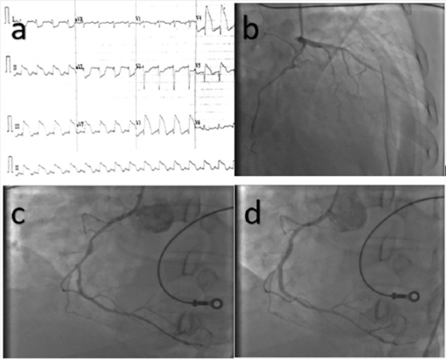 Figure 1.