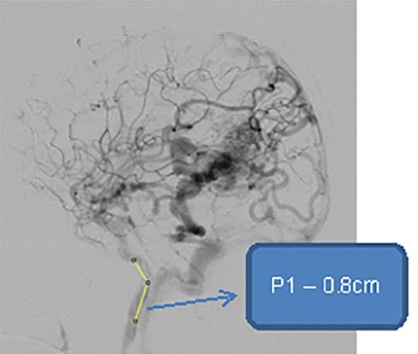 Figure4