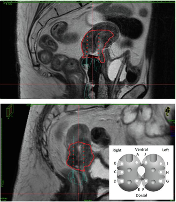 Fig. 1