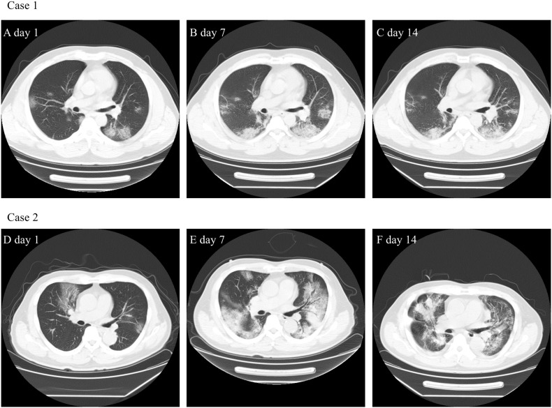 Fig. 1