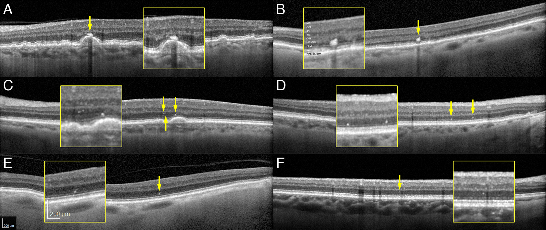 Figure 1: