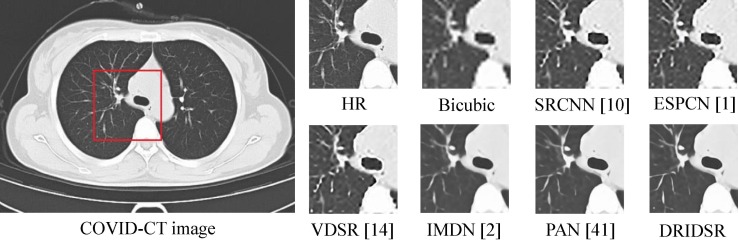 Fig. 11