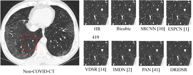 Fig. 9