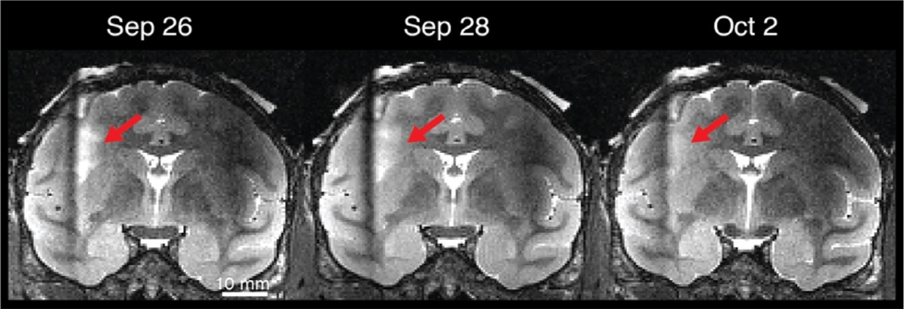 Fig. 18.