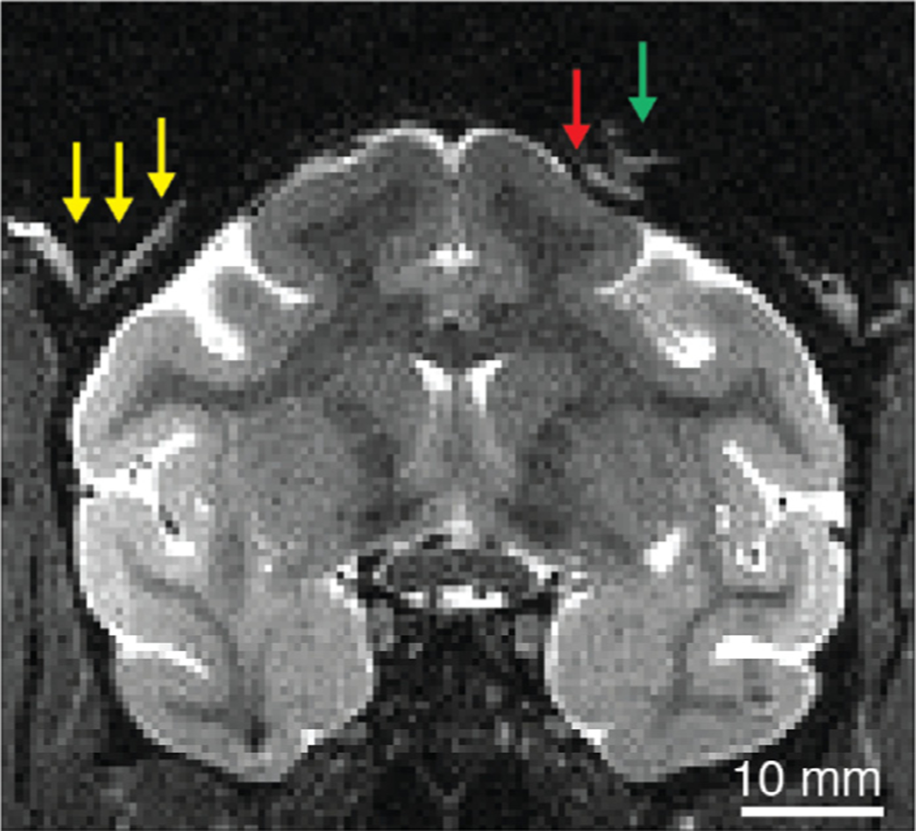 Fig. 14.