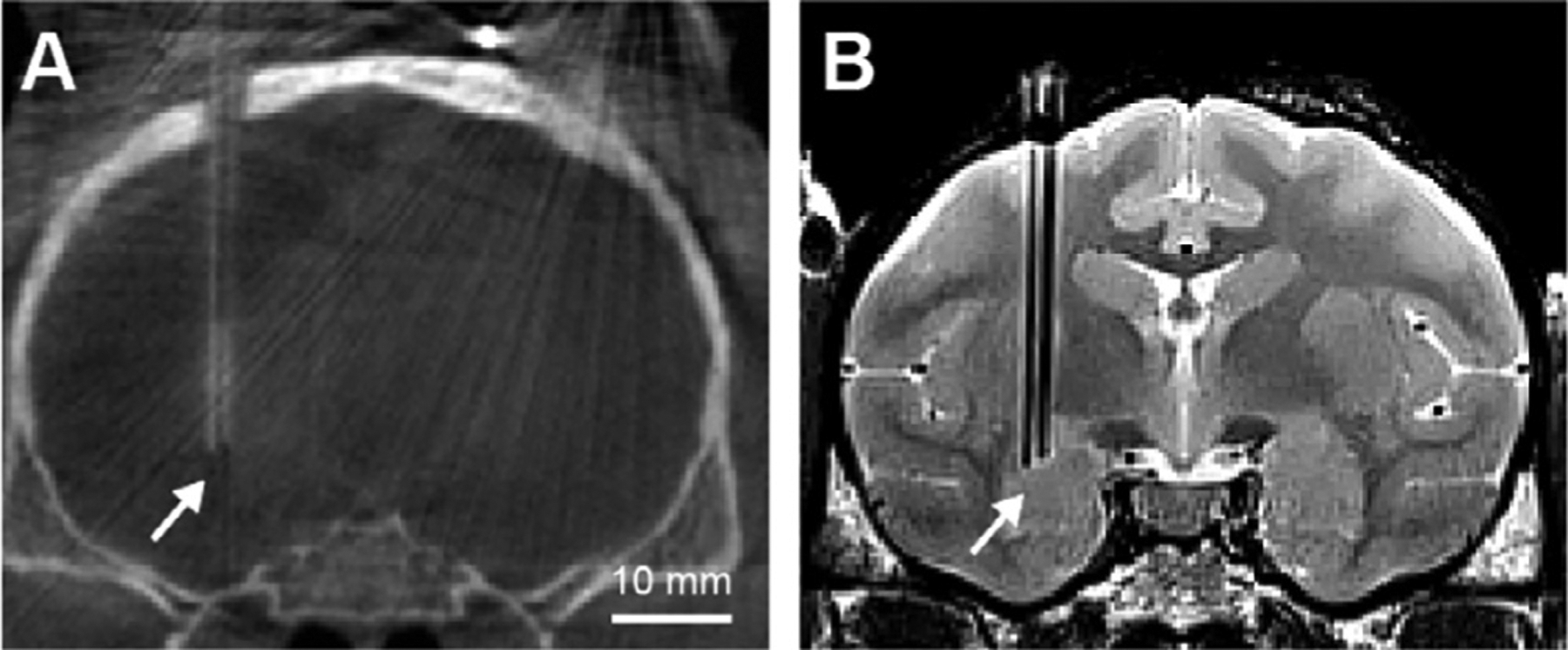 Fig. 12.