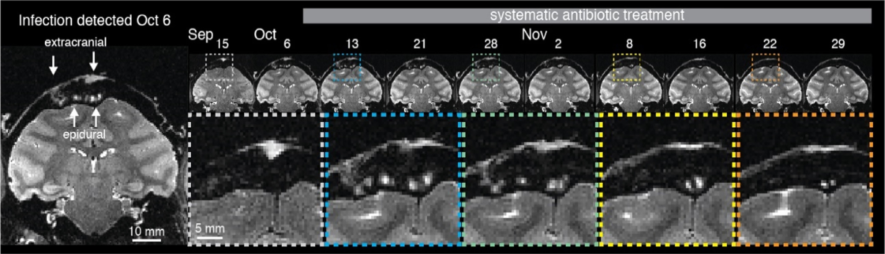 Fig. 16.