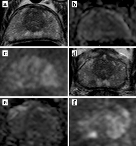 FIG. 1.