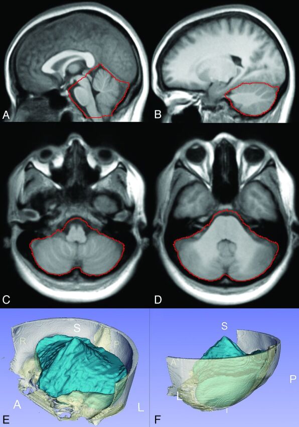 Fig 2.