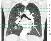 Division of chest CT data set into 10 contiguous axial slices.>