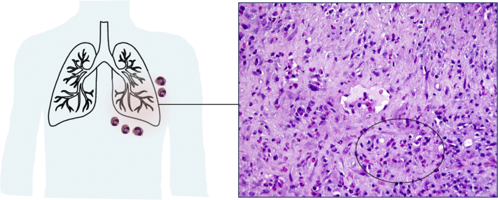 Figure 1