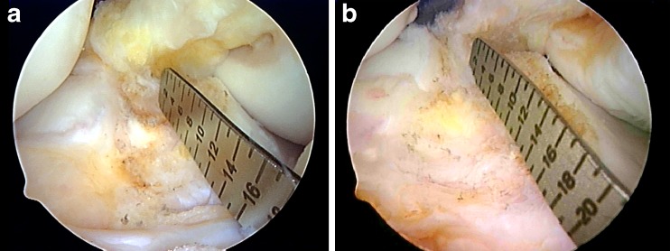 Fig. 11