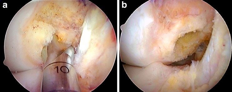 Fig. 25