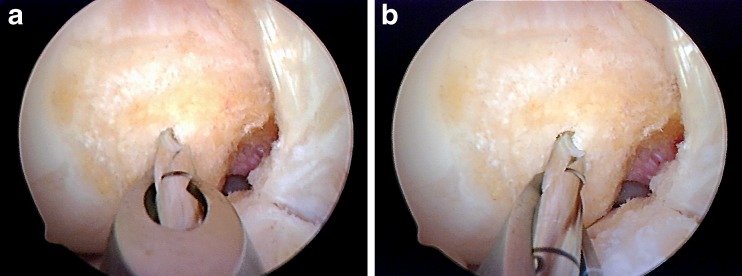 Fig. 24