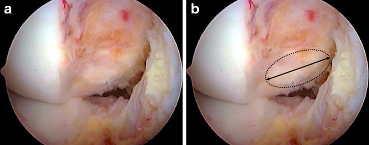 Fig. 17