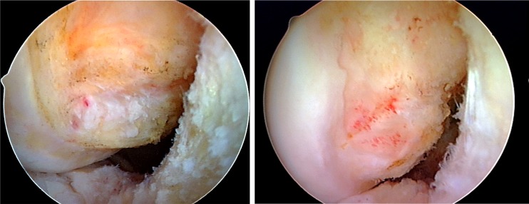 Fig. 12