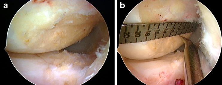 Fig. 19