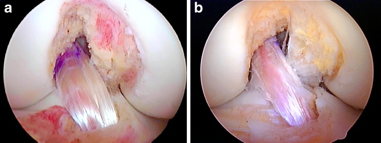 Fig. 33