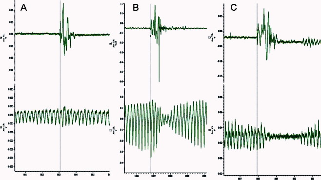 FIG. 1