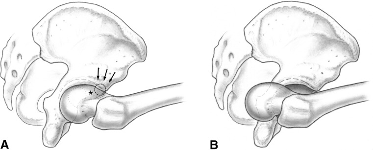 Fig. 3A–B