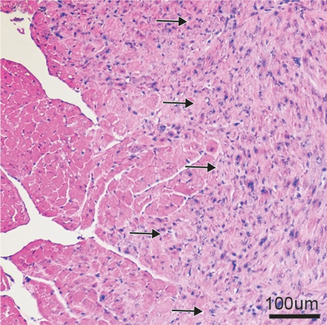 Figure 1d: