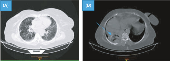 FIGURE 1