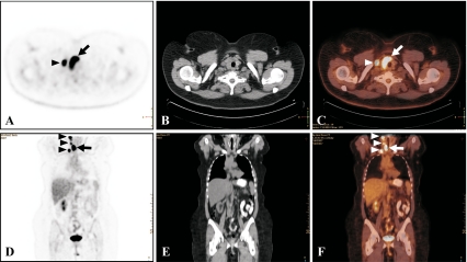 Fig. 2