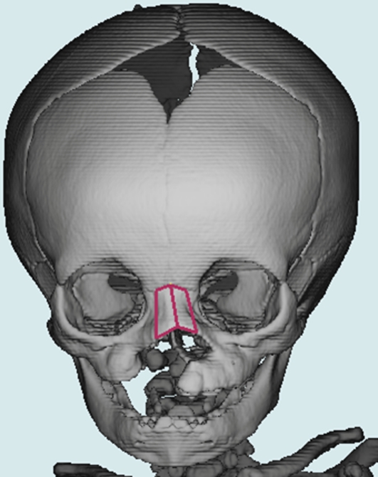 Figure 3: