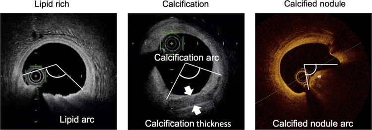 Fig 3