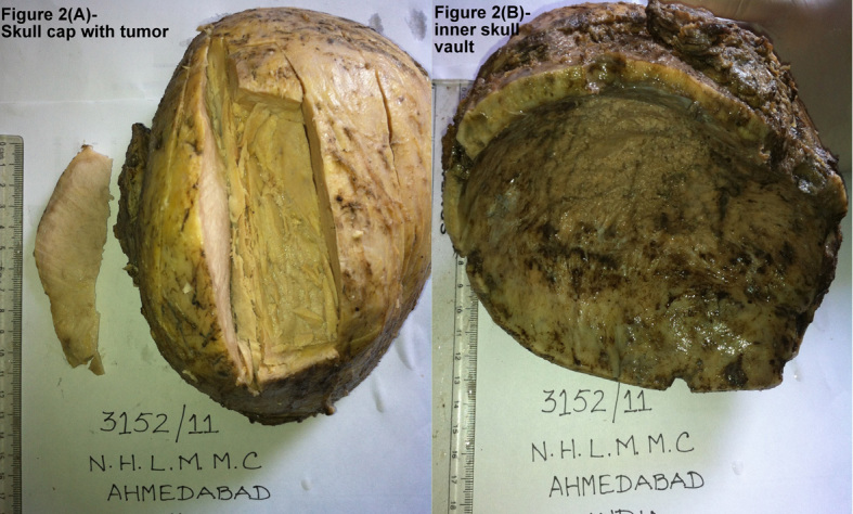 [Table/Fig-2]: